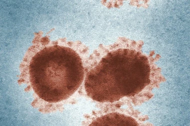ŠPANIJA PONOVO OBARA CRNE REKORDE: 55.019 novih slučajeva koronavirusa, 379 preminulih